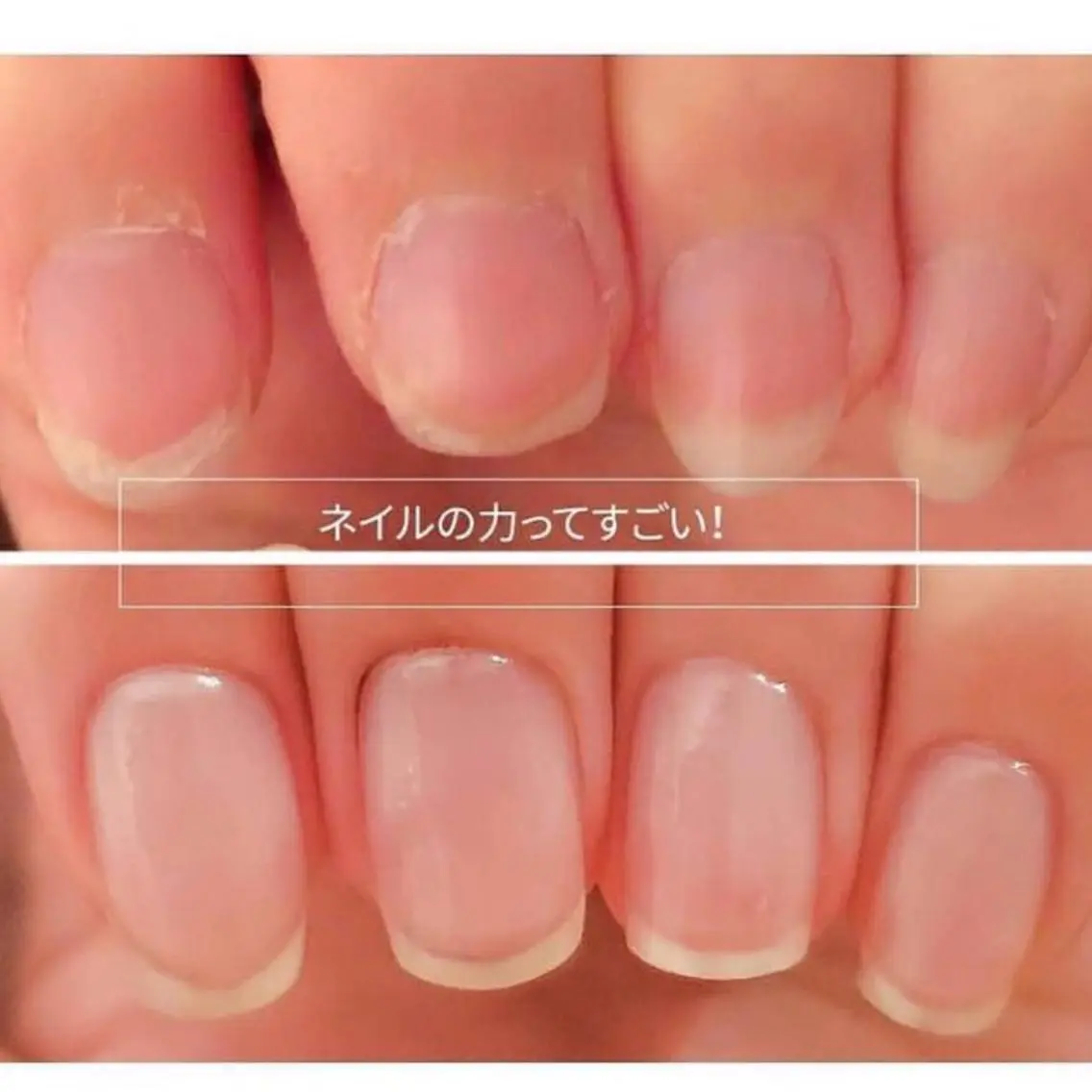 最強の美爪にするネイルケア3ヶ月間、合計8回のご来店でケアしてコンフレックスを解消 ❣️の写真