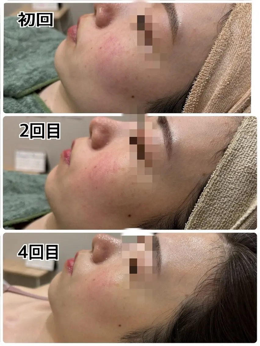 エステ 心斎橋/美肌管理専門 muroのエステ・リラクイメージ