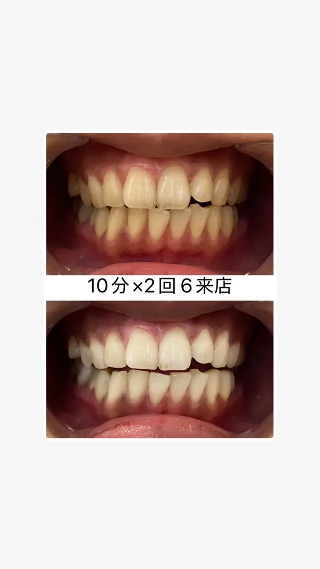 エステ ホワイトニングサロン スズキのエステ・リラクイメージ