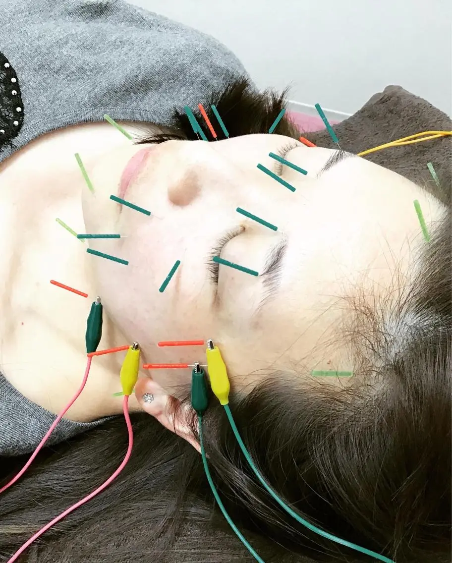 【電気美容鍼】【1番人気】💖楊貴妃コース❗️の写真