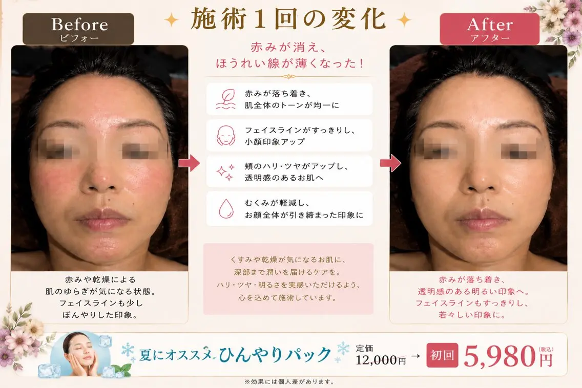 【うるツヤ美肌】ひんやりモデリングパックフェイシャル60分|毛穴・乾燥・肌ケアに✨の写真