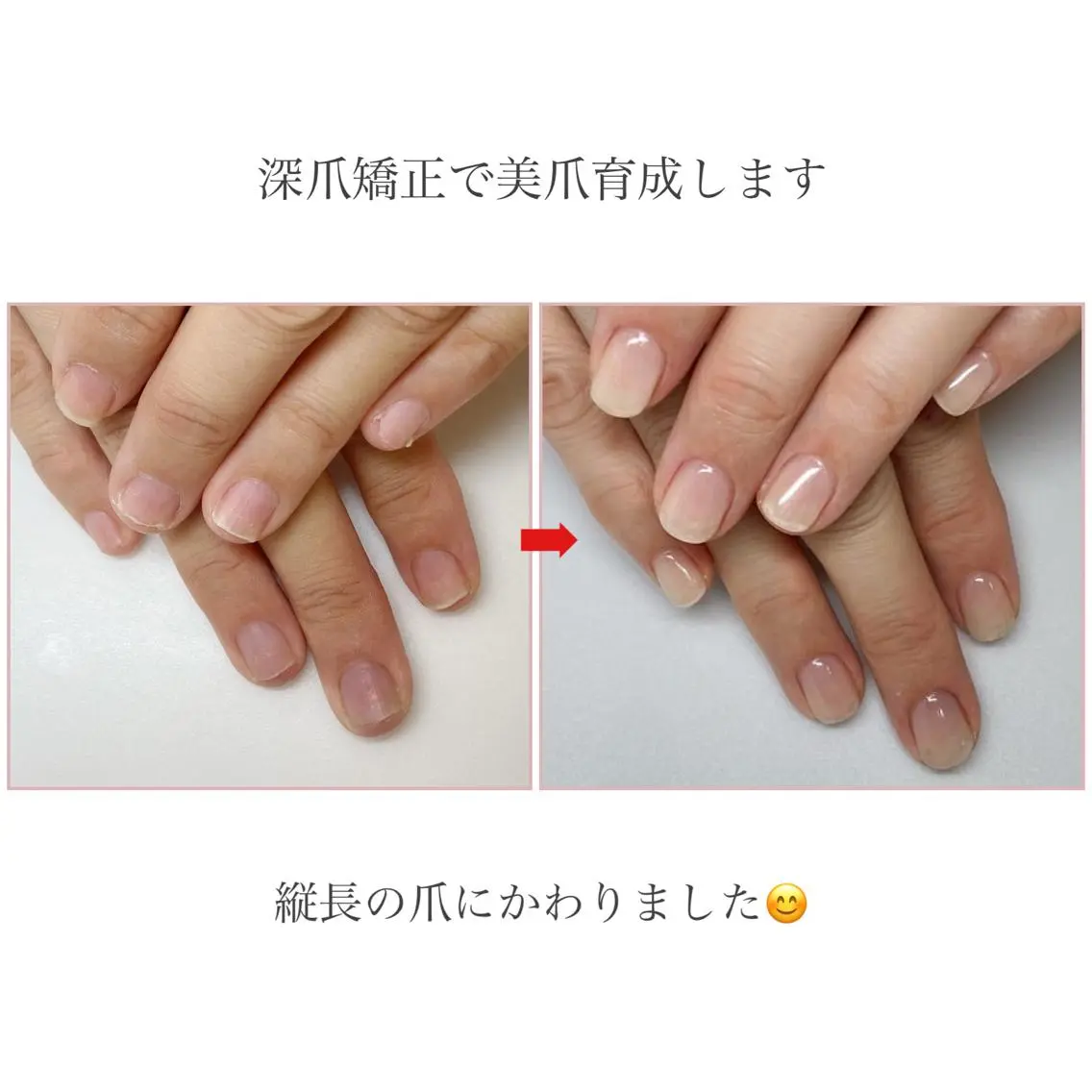 ネイル ネイルサロン アリュームのネイルデザイン