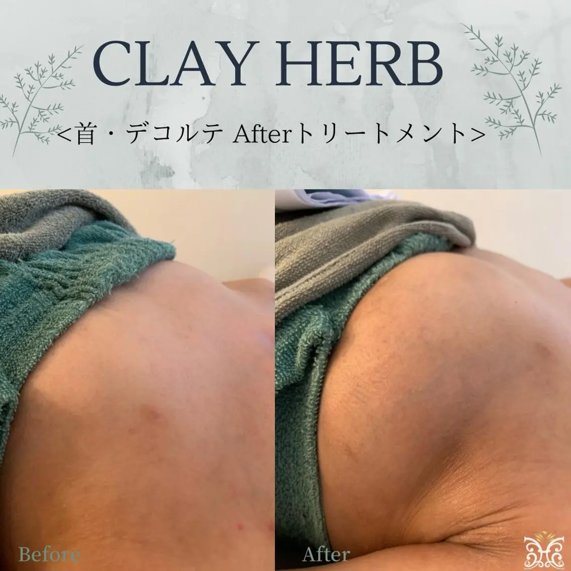 エステ リラク cerisier BEAUTÉのエステ・リラクイメージ