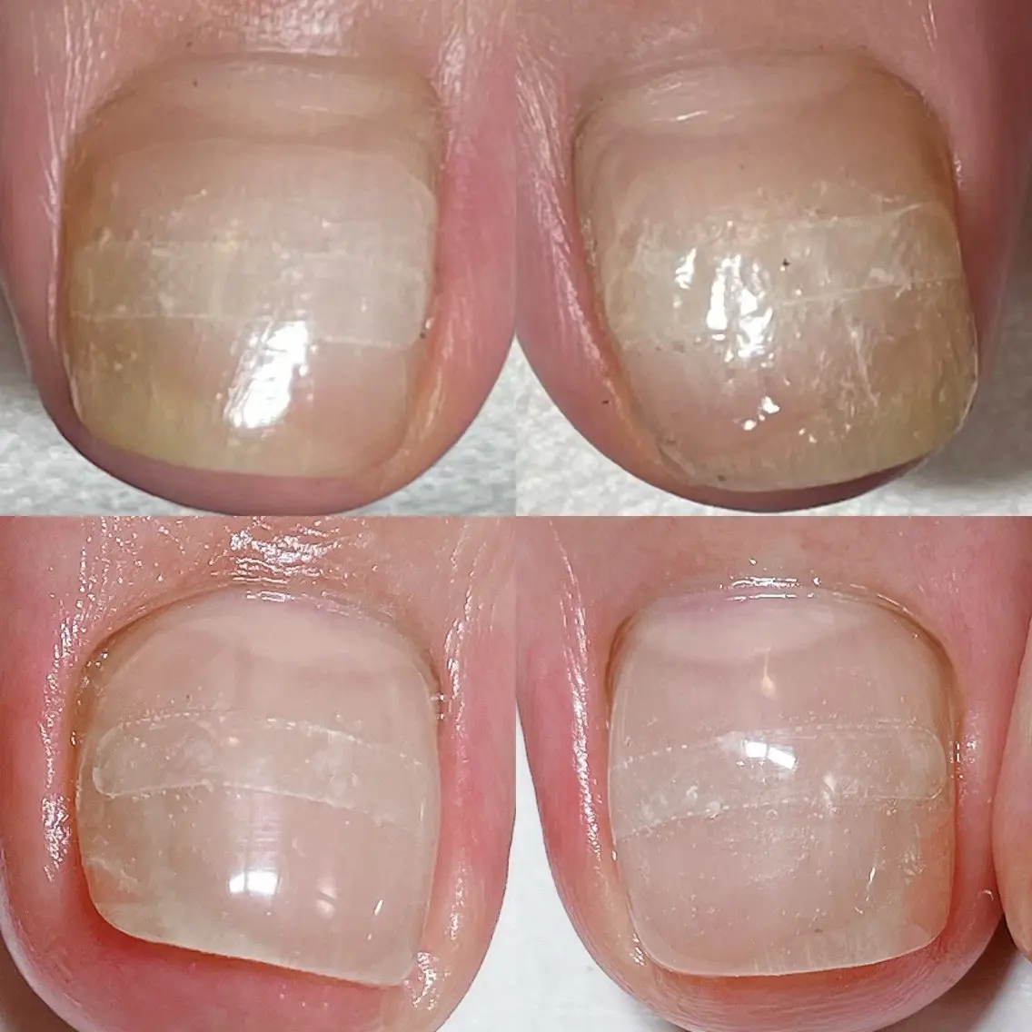 ネイル フットネイル .Nails Mio 赤羽西ネイルサロンのネイルデザイン