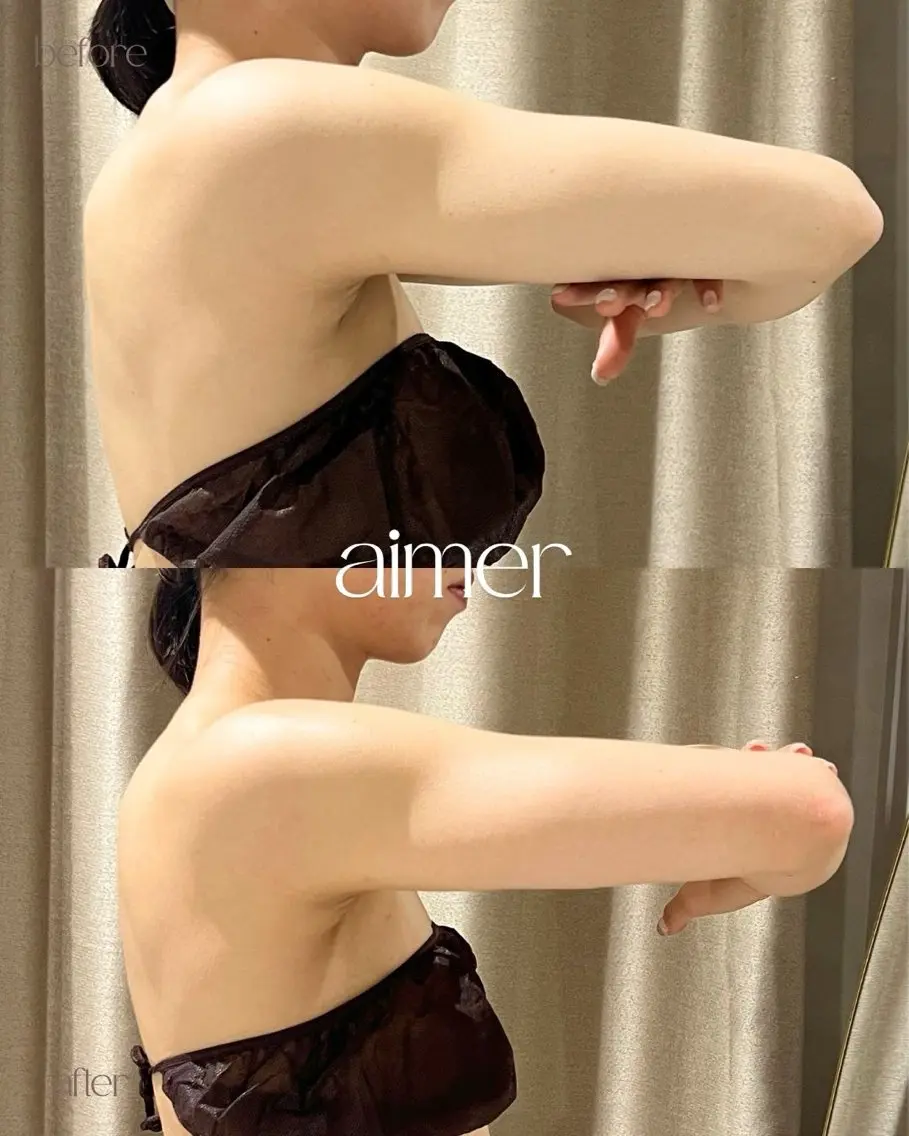 aimer服部 /  小顔 ・ 痩身のその他イメージ