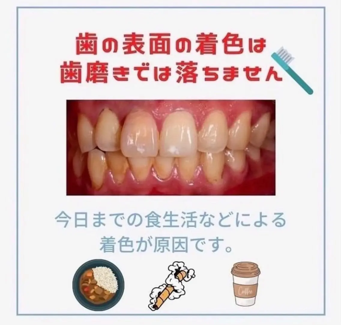 ホワイトニング ショップ伊丹店のその他イメージ