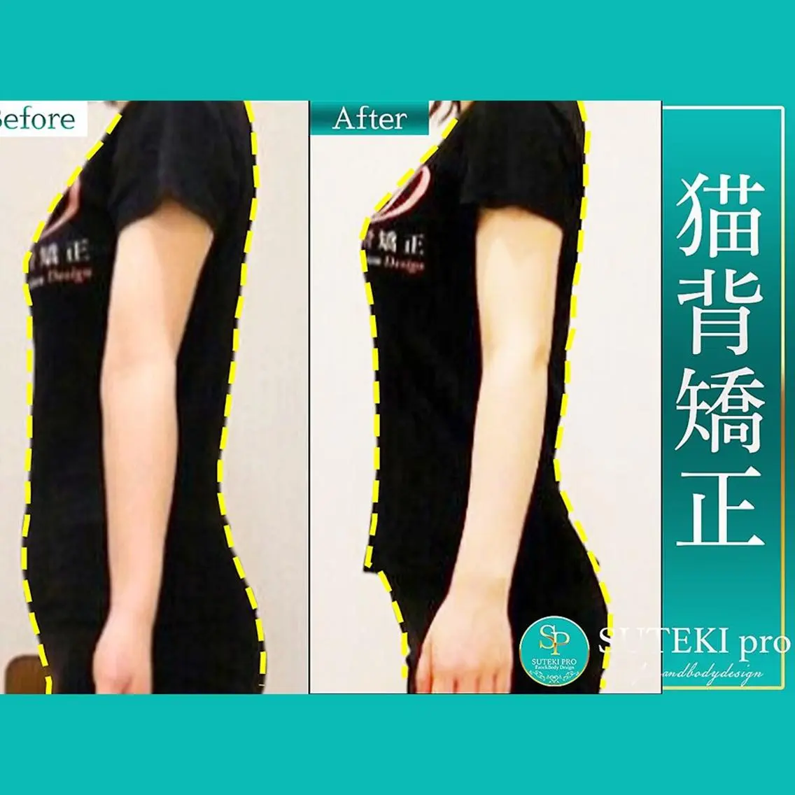 【巻き肩集中整体】スマホ・デスクワークで前に出た巻き肩をリセット ¥4400→ カウンセリング含む全体30分の写真