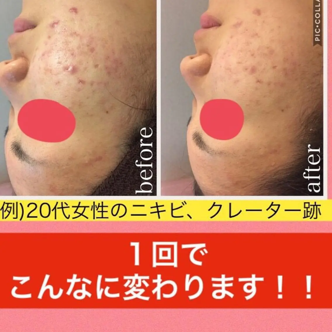 ミディアム カラー パーマ ヘアアレンジ メンズ キッズ ネイル マツエク・マツパ エステ リラク ニキビ・肌質改善専門 ♡人生が変わるサロンのエステ・リラクイメージ