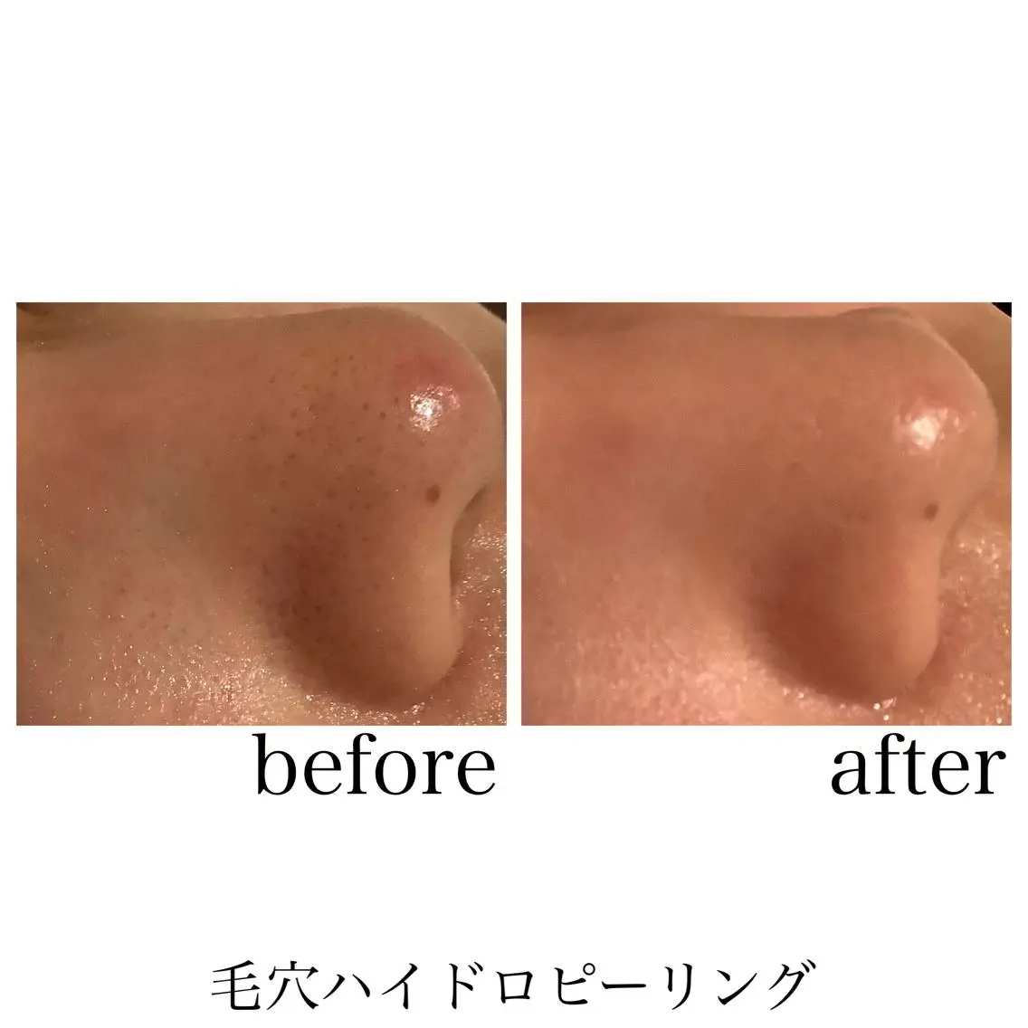 脱毛&エステサロン JIGGLY武蔵小山のエステ・リラクイメージ
