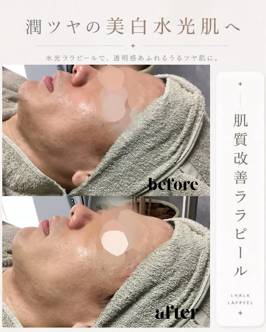 メンズ エステ 【BUB立川】 ゆかのエステ・リラクイメージ