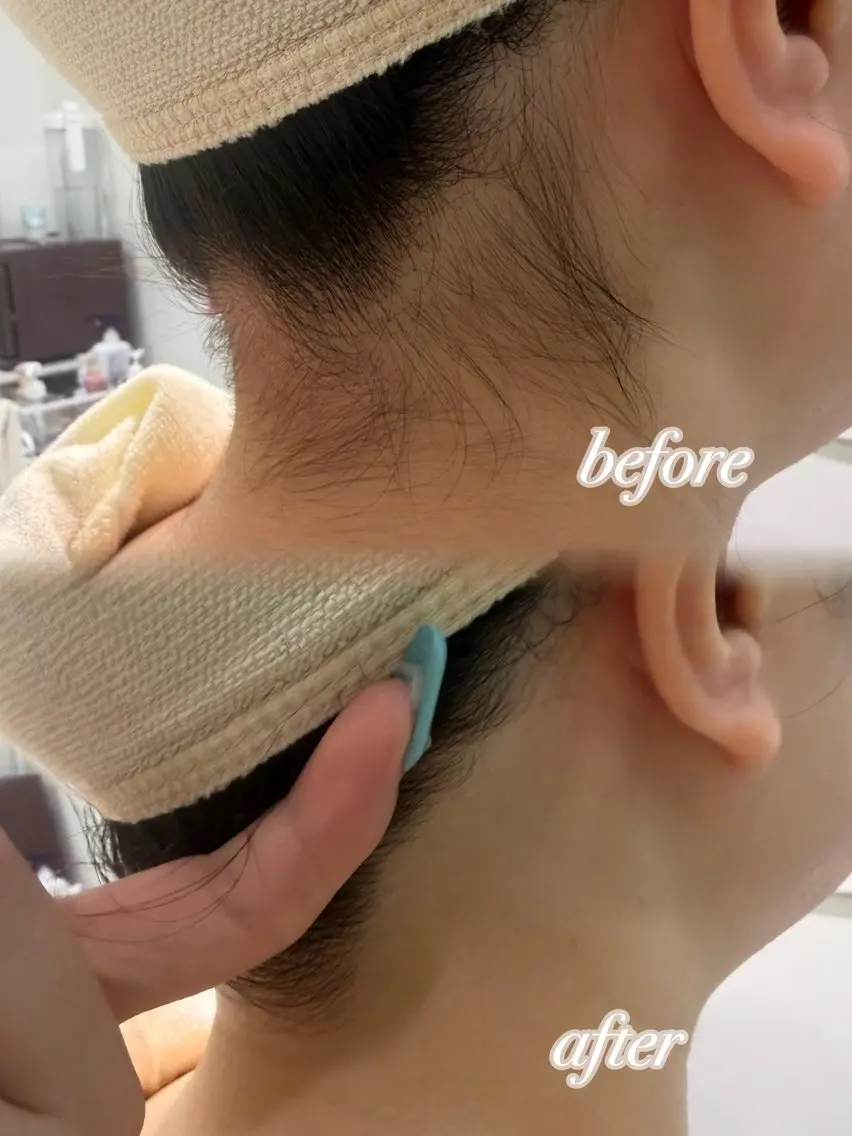その他 ぷる艶肌🫧 shaving斉藤のその他イメージ