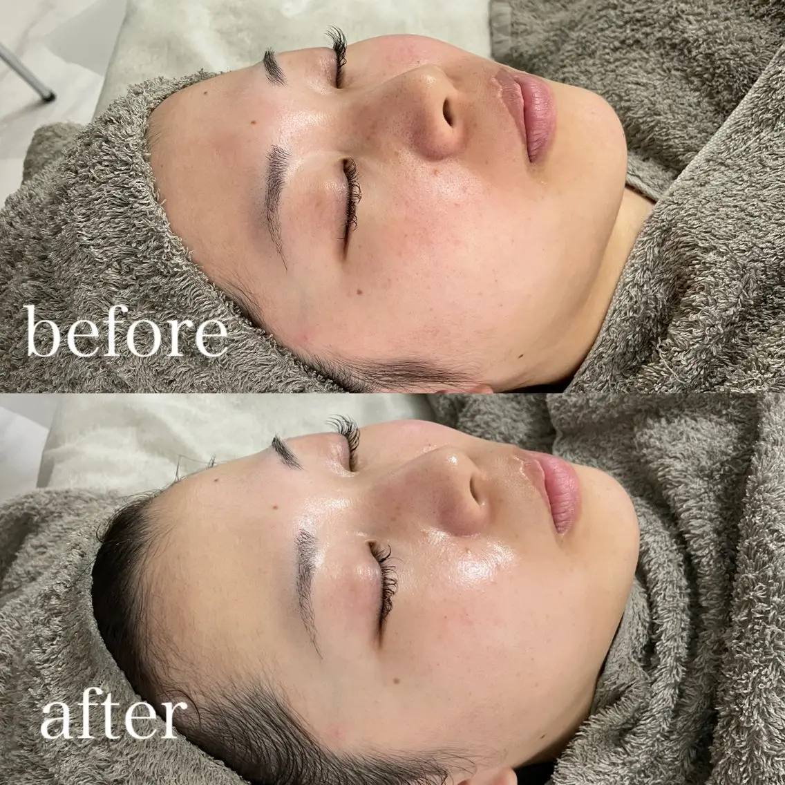 エステ SALON el 歯と肌の専門店のその他イメージ