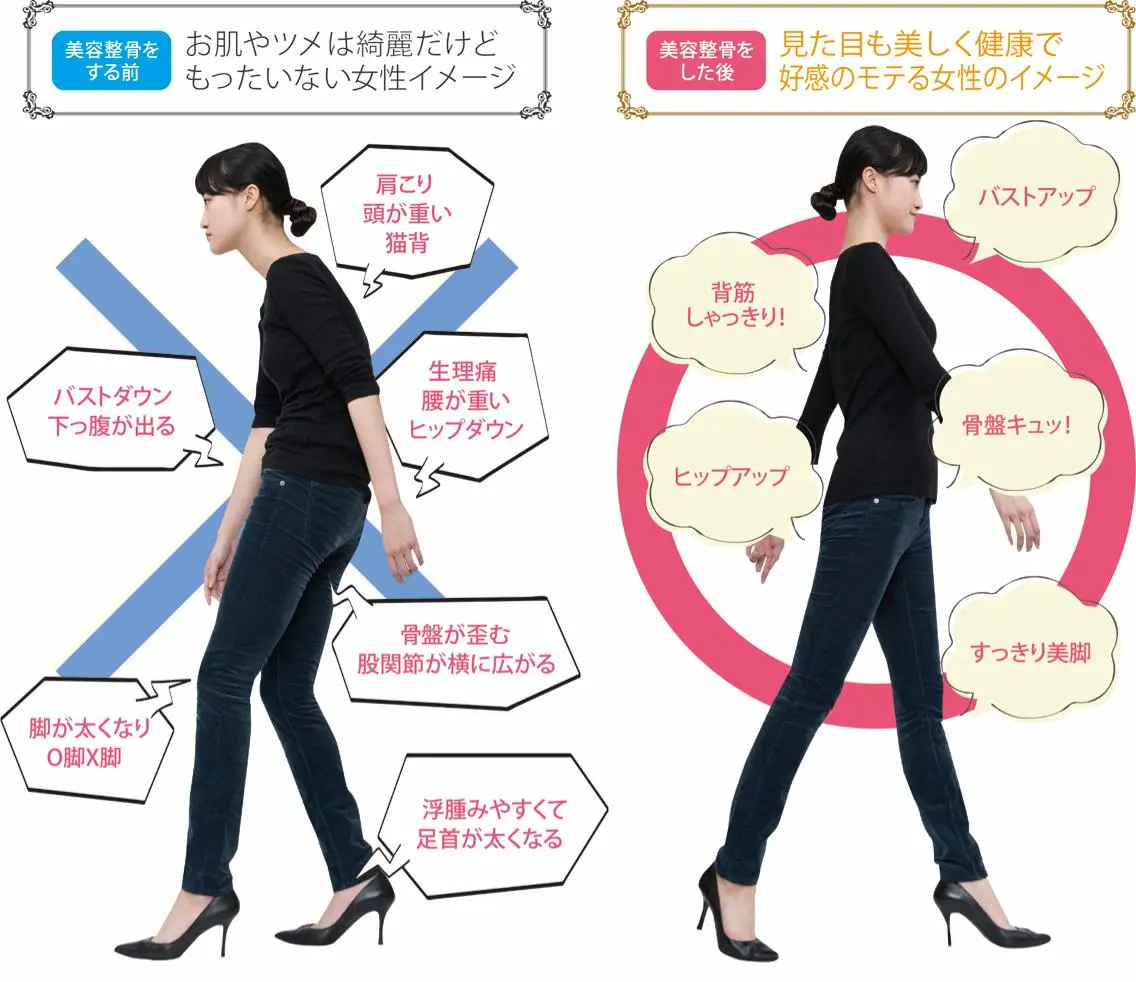 身体矯正の写真