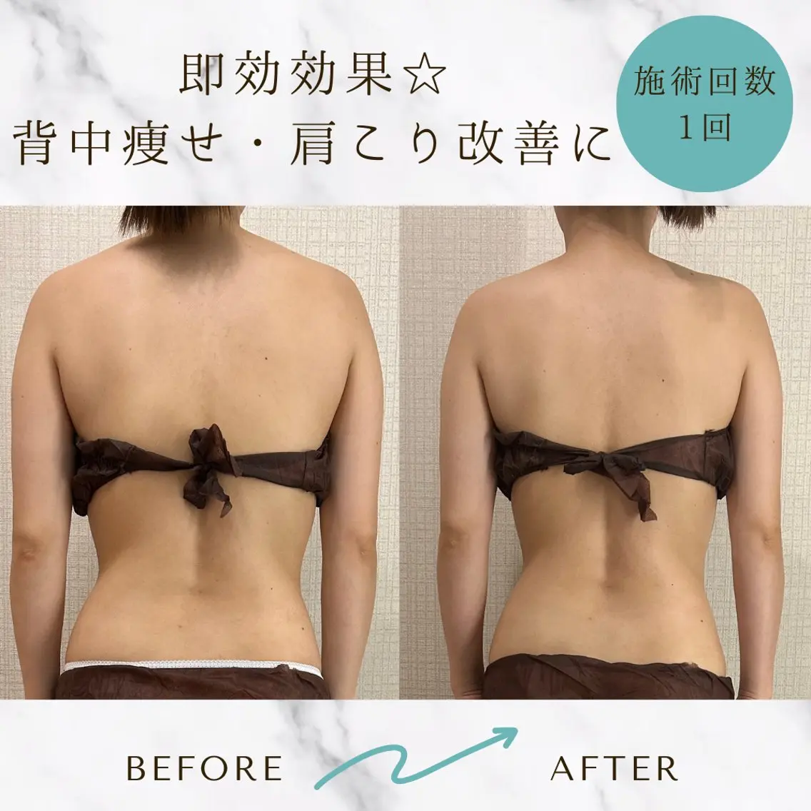 体質別リンパマッサージ60分(上半身or下半身)+最新痩身マシン10分お試しプレゼント付き🎁の写真