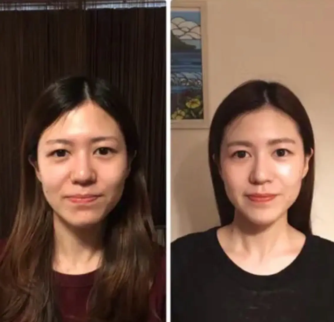 🌟ミニモ限定🌟小顔調整3回セット【小顔美容調整・首肩頭マッサージ】パック付💕の写真