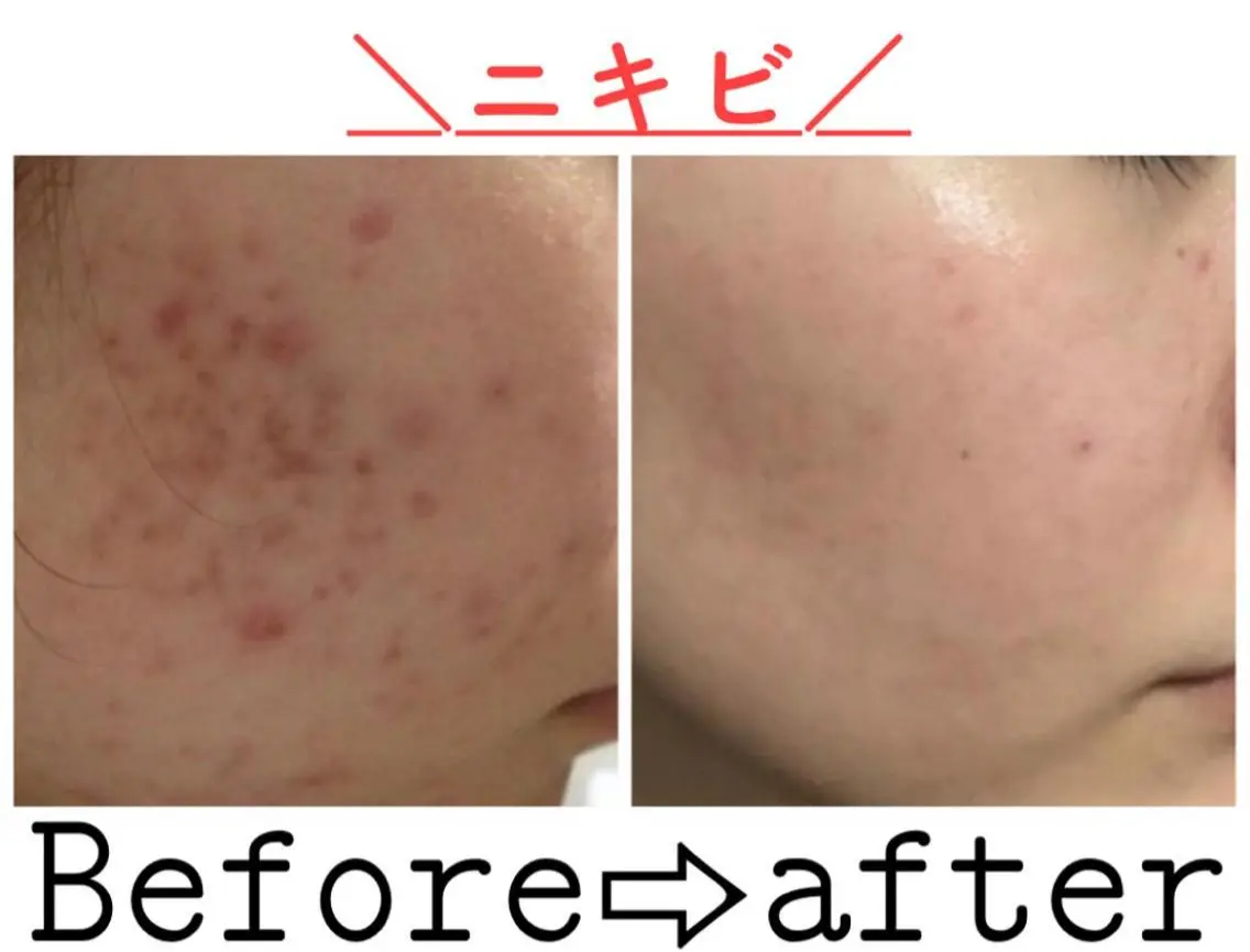 ミディアム カラー パーマ ヘアアレンジ メンズ キッズ ネイル マツエク・マツパ エステ ニキビ&跡改善サロン オーナー光木のエステ・リラクイメージ