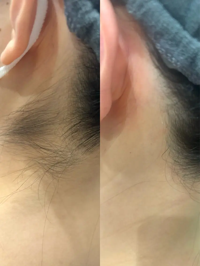うなじWAXの写真