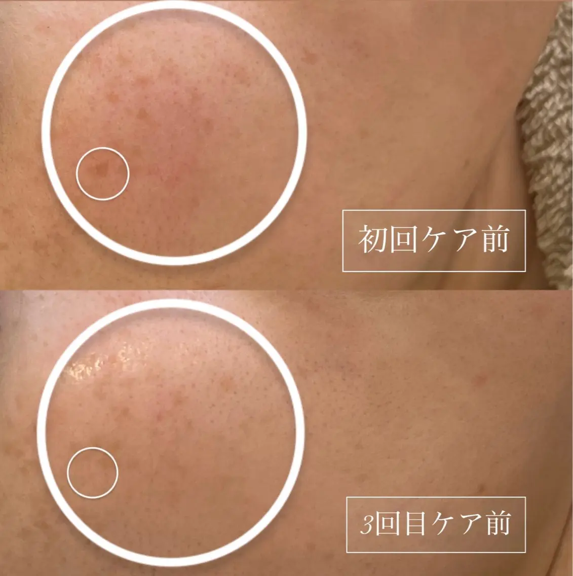 エステ LUMY GRATiAEのエステ・リラクイメージ