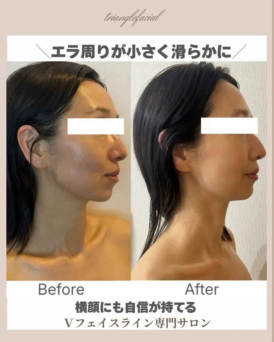 小顔サロン (ラ リュミエール)のエステ・リラクイメージ