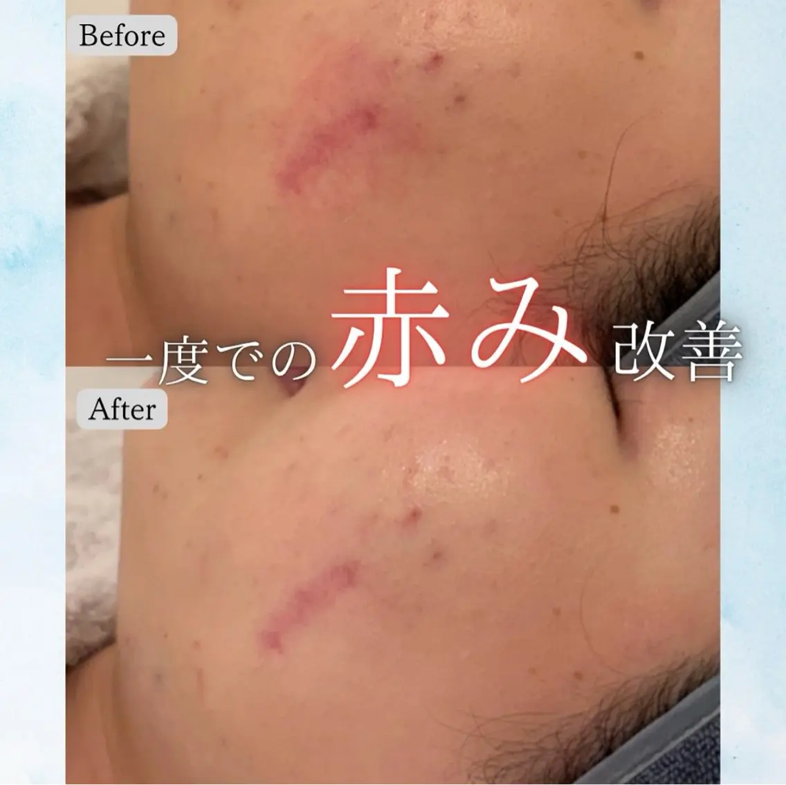 髙山 美優のエステ・リラクイメージ