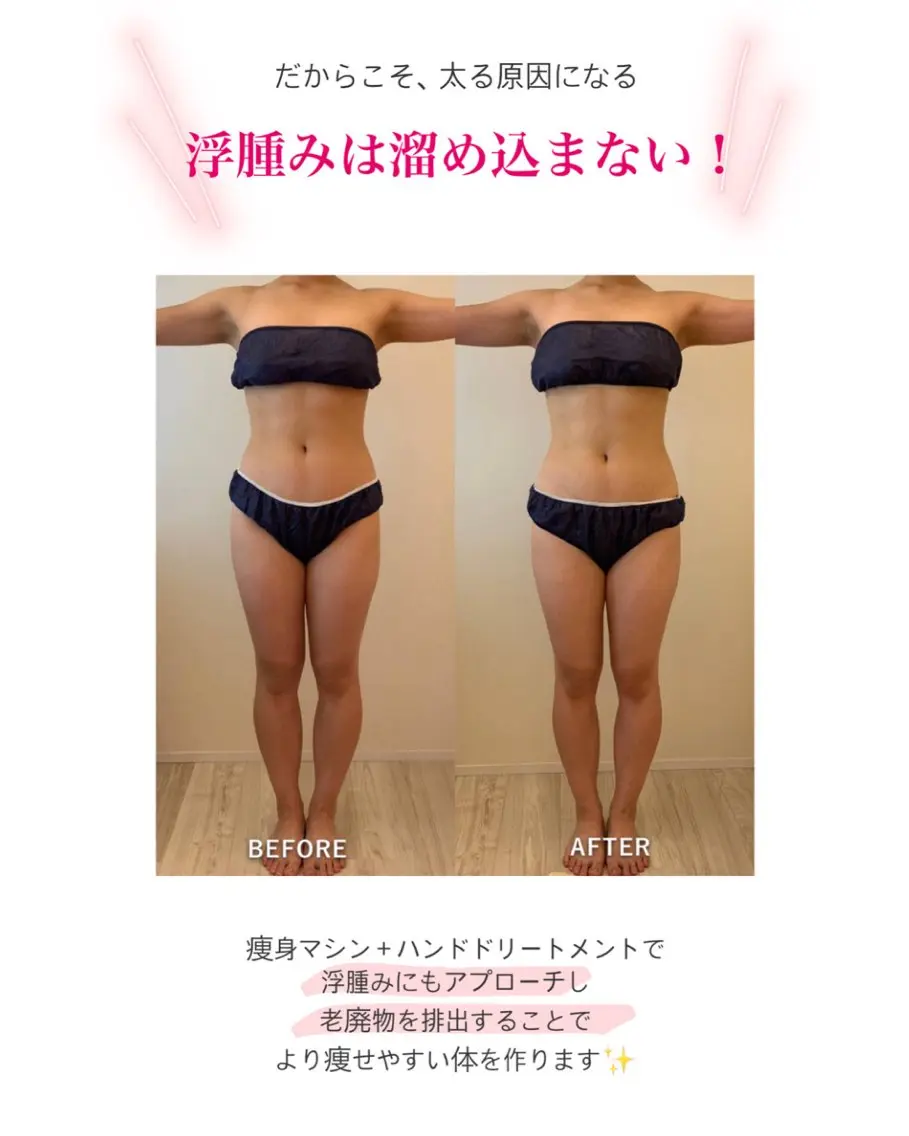 産後ダイエット−9㎏ Pourvous結衣のエステ・リラクイメージ