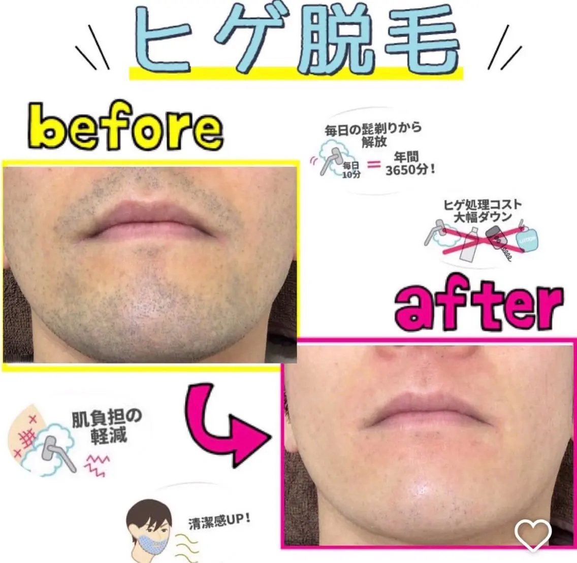 脱毛 RILsalon 脱毛/フェイシャルのエステ・リラクイメージ