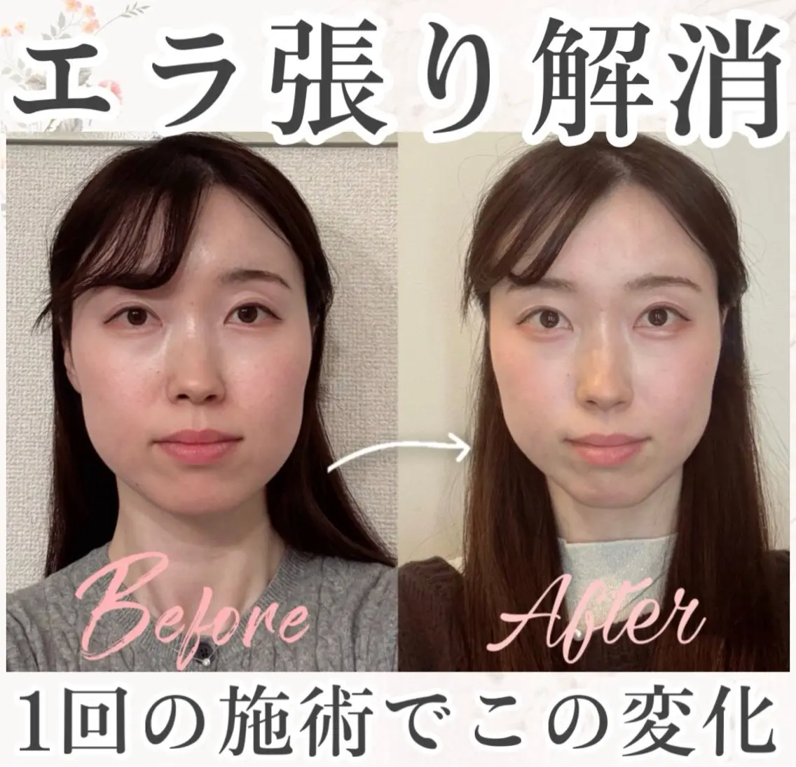 小顔矯正専門 🪽アシュネ平野のエステ・リラクイメージ