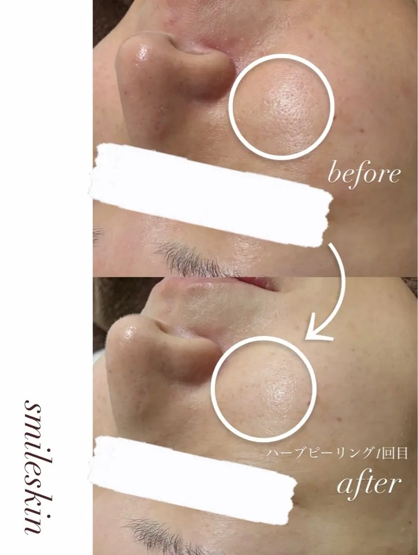 その他 smileskin 京都／meguのその他イメージ