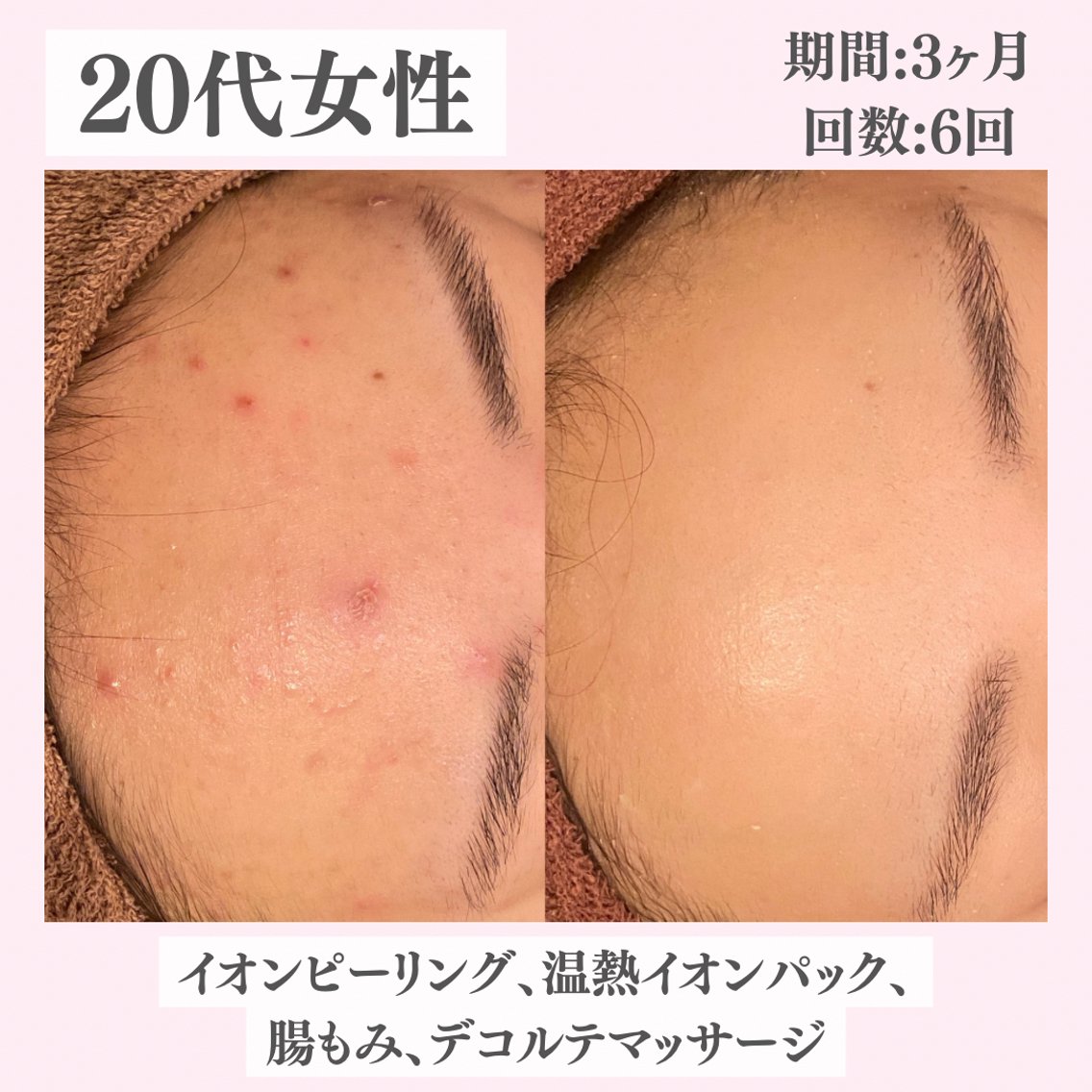 エステ リラク ニキビ・肌質改善専門 ♡人生が変わるサロンのエステ・リラクイメージ