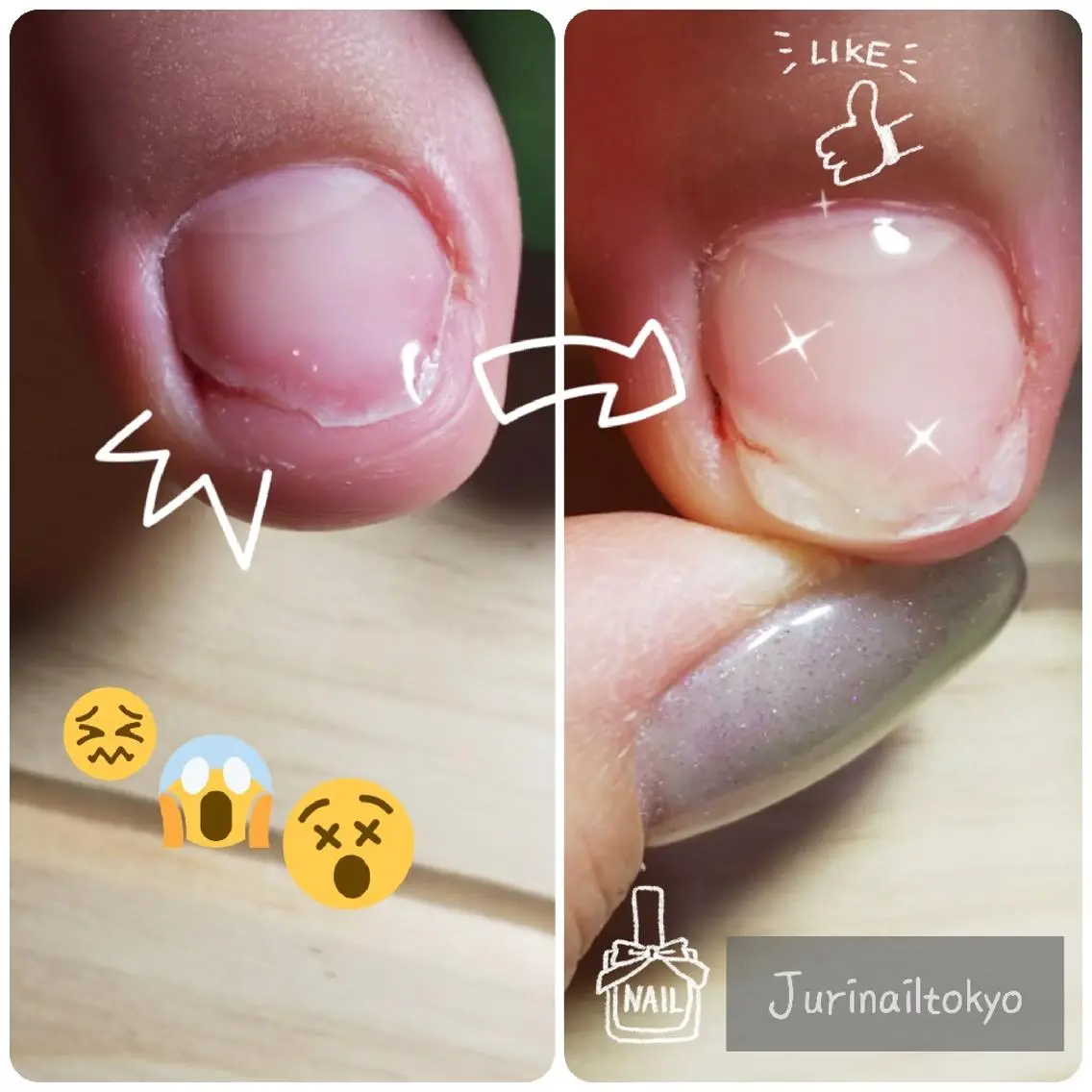 足爪 綺麗に!薄い爪、折れたつめおすすめです(1本)このメーニュはジェルをやるときのメーニュでございますの写真