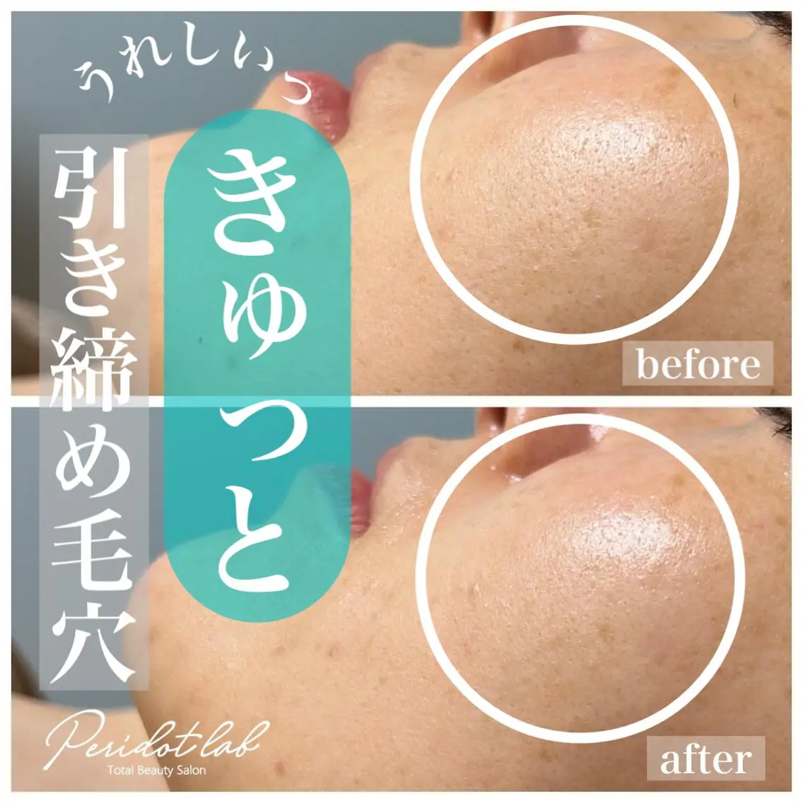 ペリドットラボ naoのエステ・リラクイメージ
