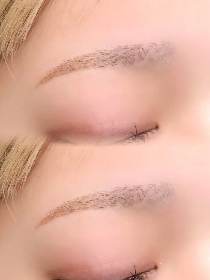 ワックス脱毛の写真