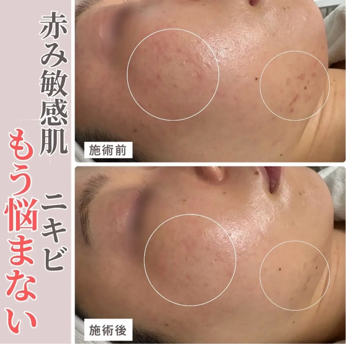 🫧美肌&体質改善 🌿mitekiのエステ・リラクイメージ