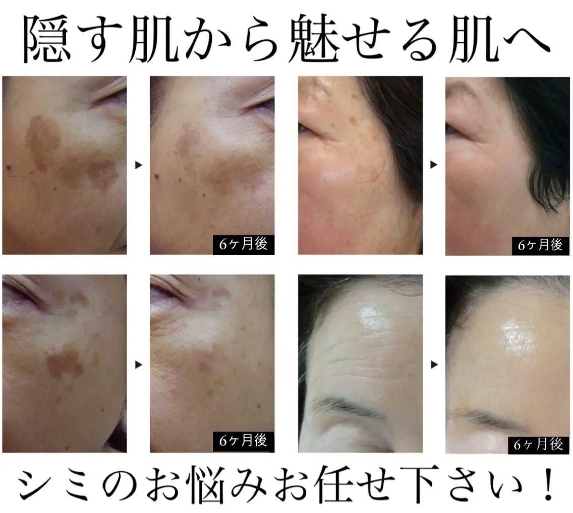 エステ リラク シミ毛穴専門店 yucca(ユッカ)のエステ・リラクイメージ