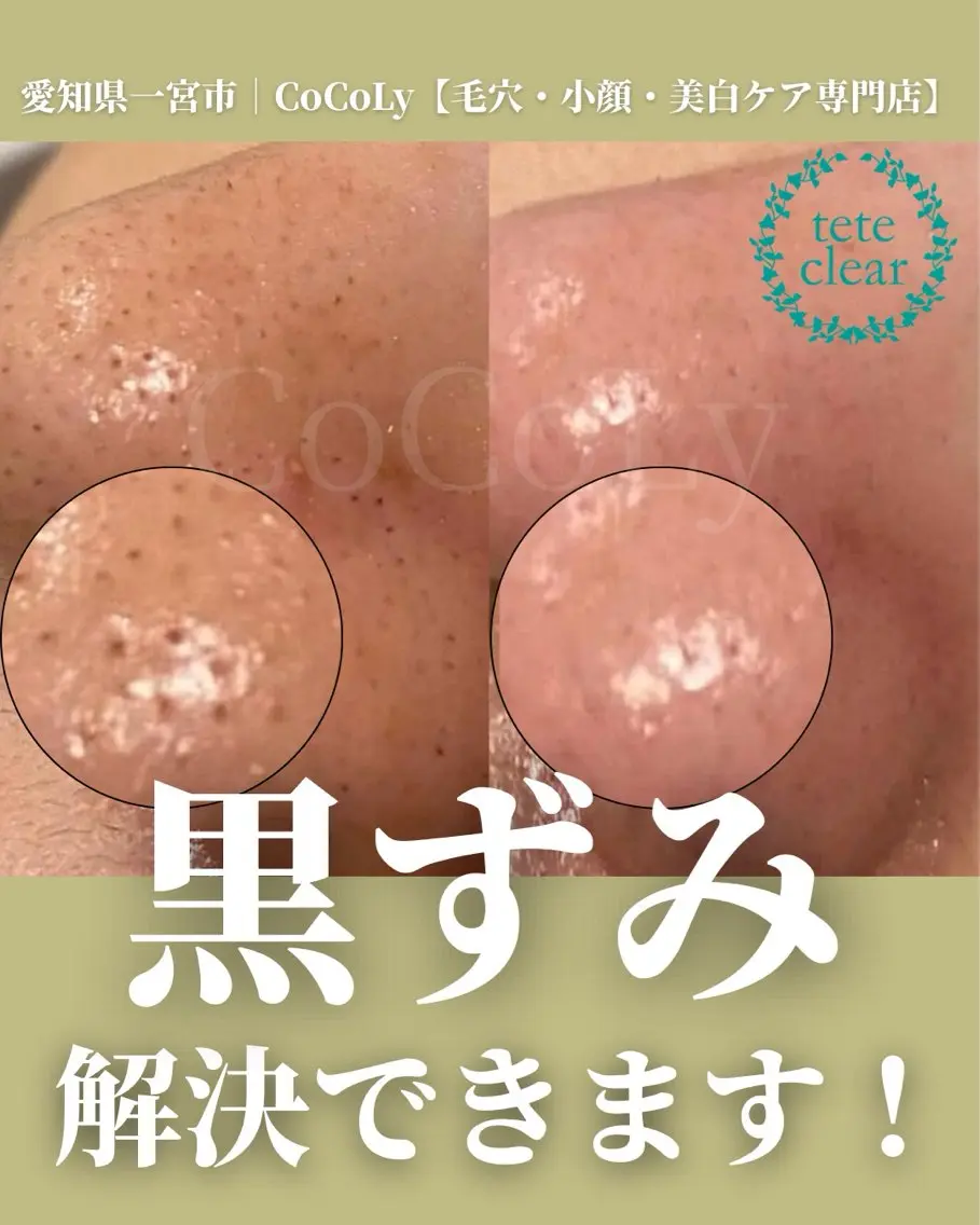 エステ 田中 里沙のエステ・リラクイメージ
