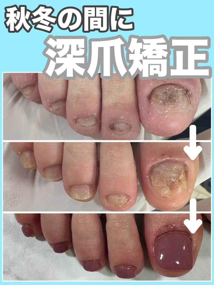 ネイル フットネイル nail salon petillantのネイルデザイン