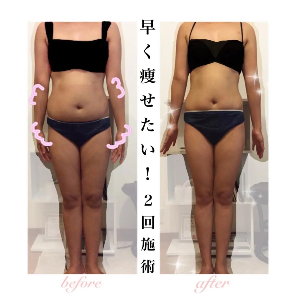 エステ リラク ダイエット・美肌ケア fleurのエステ・リラクイメージ