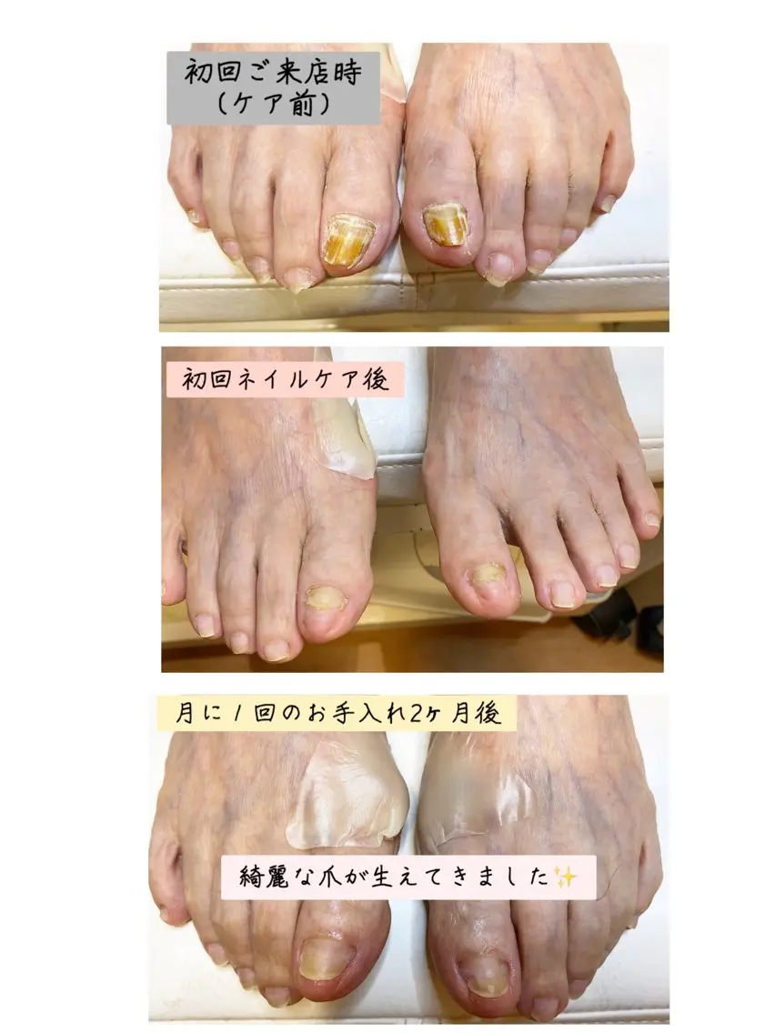 ネイル フットネイル フットネイル Studio Jivanのネイルデザイン