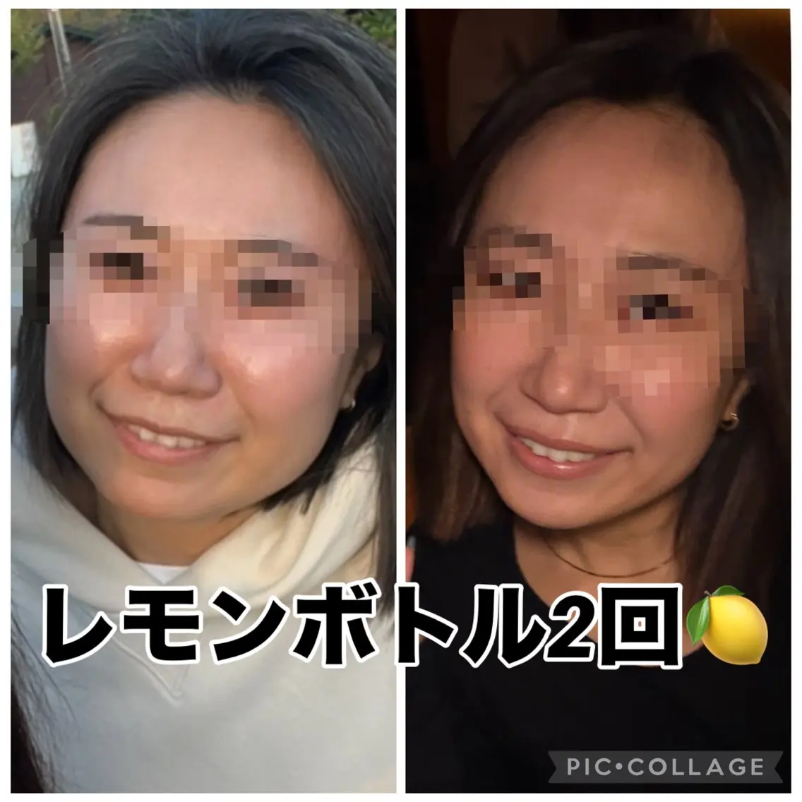 艶肌小顔フェイシャル❣️温熱マシン(全顔＆肩首)×小顔矯正×超音波で美容液導入✨エイジングケアにも◎の写真