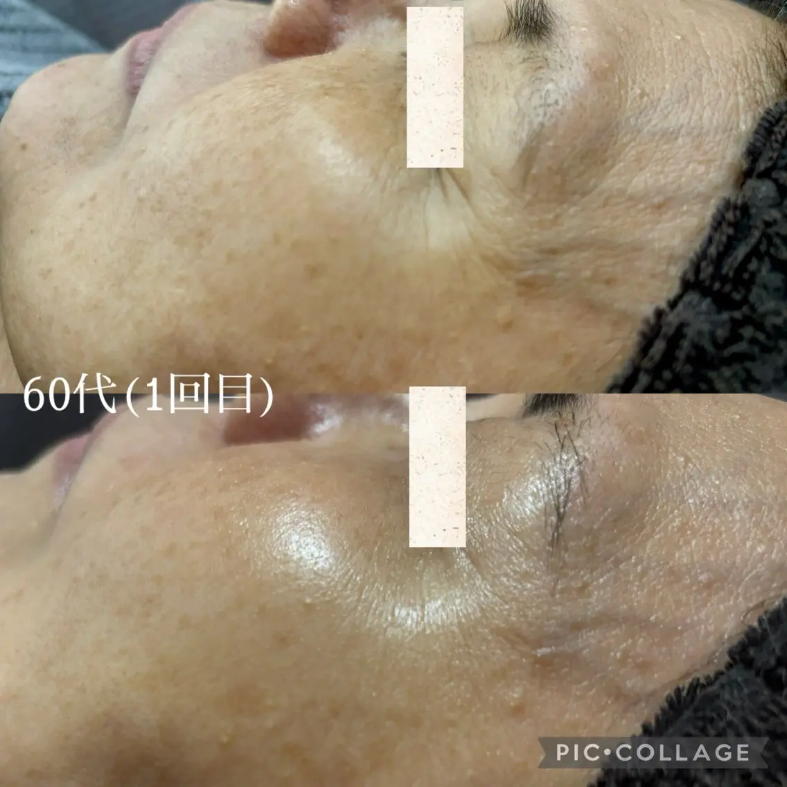 メンズ エステ Beauty Salonheartのエステ・リラクイメージ