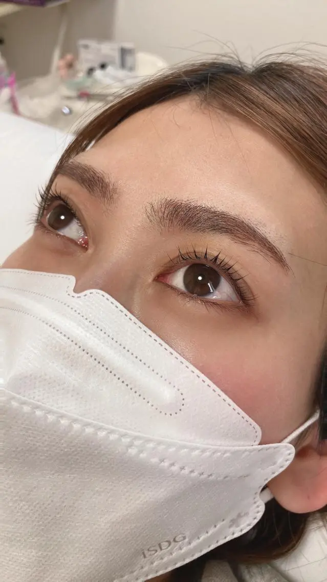 ラッシュリフト　上下の写真