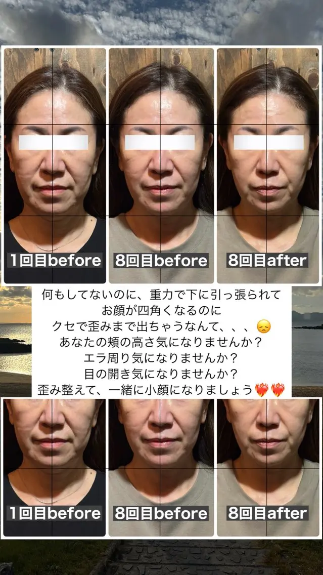 エステ リラク 💎後悔させない小顔 矯正💎イトヤマ🌱のエステ・リラクイメージ