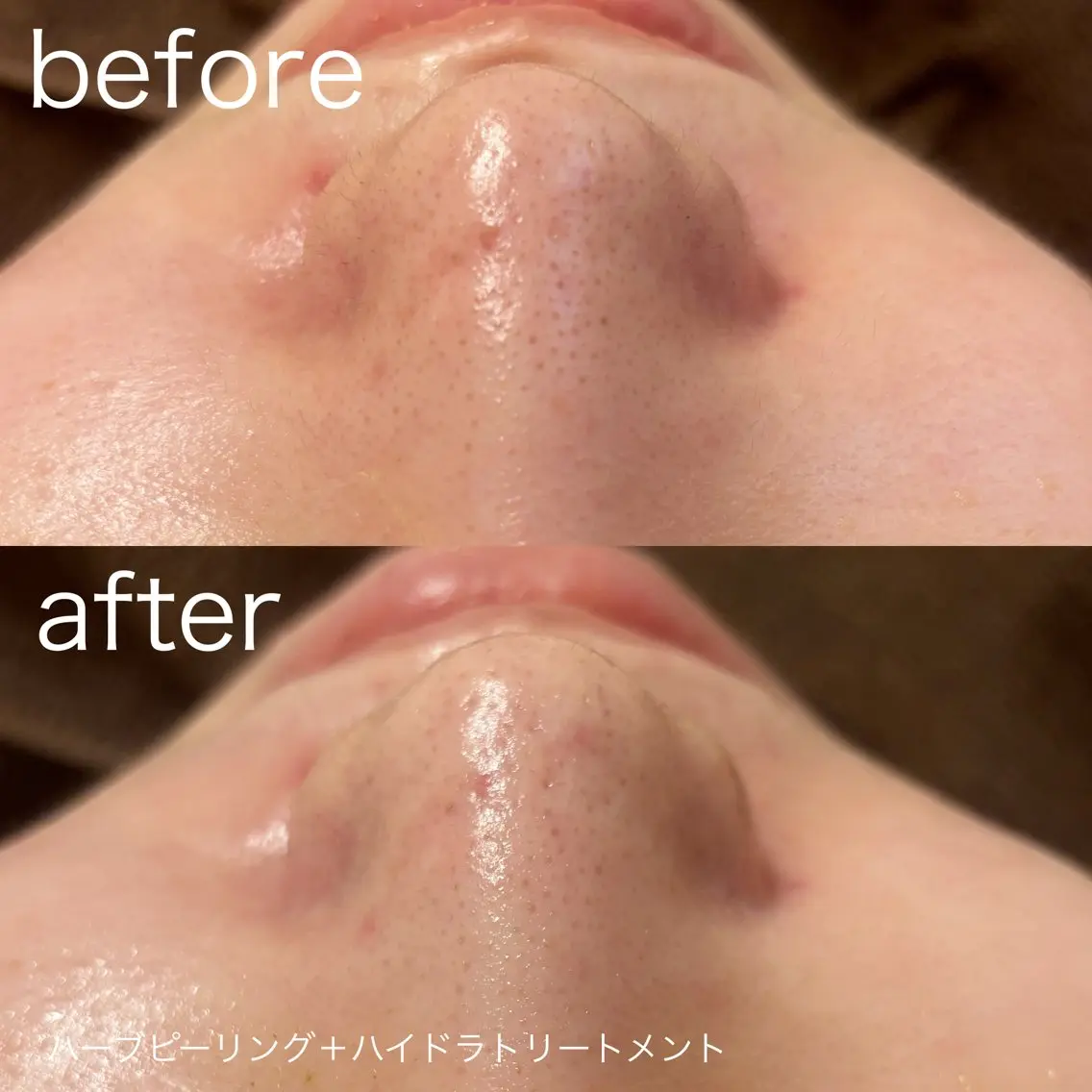 脱毛 lulularico Yuのネイルデザイン