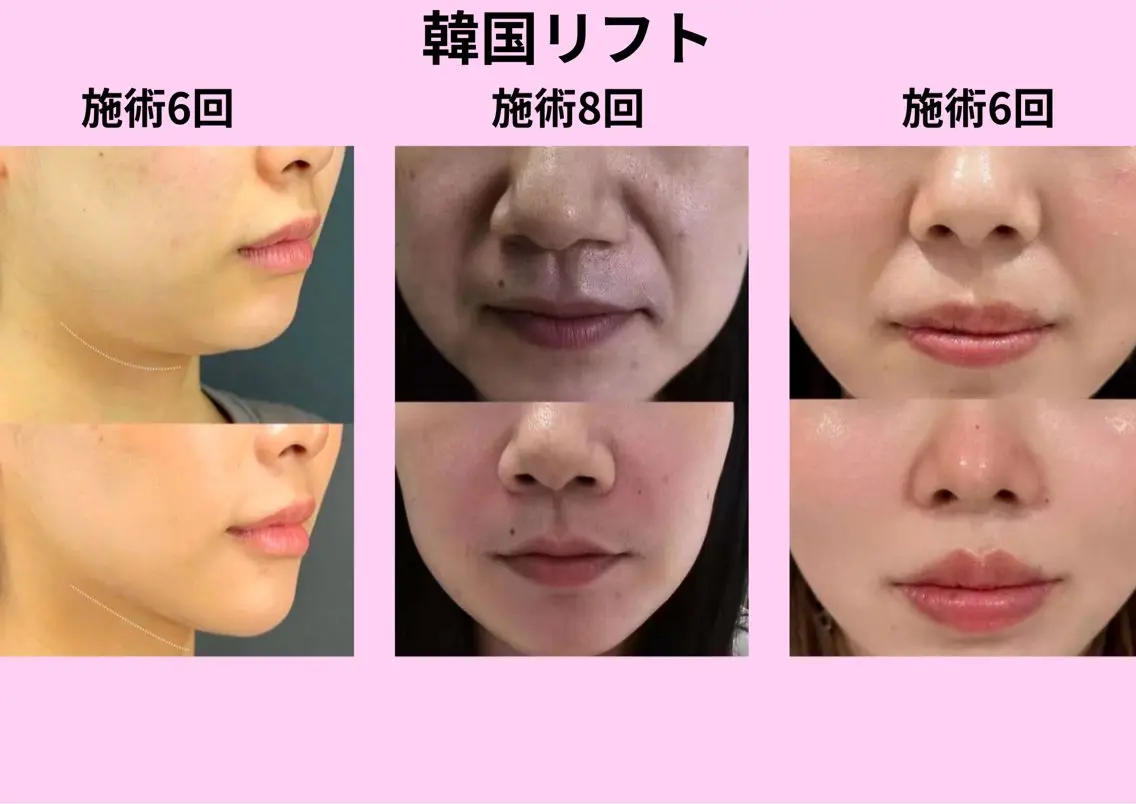 マツエク・マツパ エステ リラク 愛維美水光美肌専門店 メンズレディースokのエステ・リラクイメージ