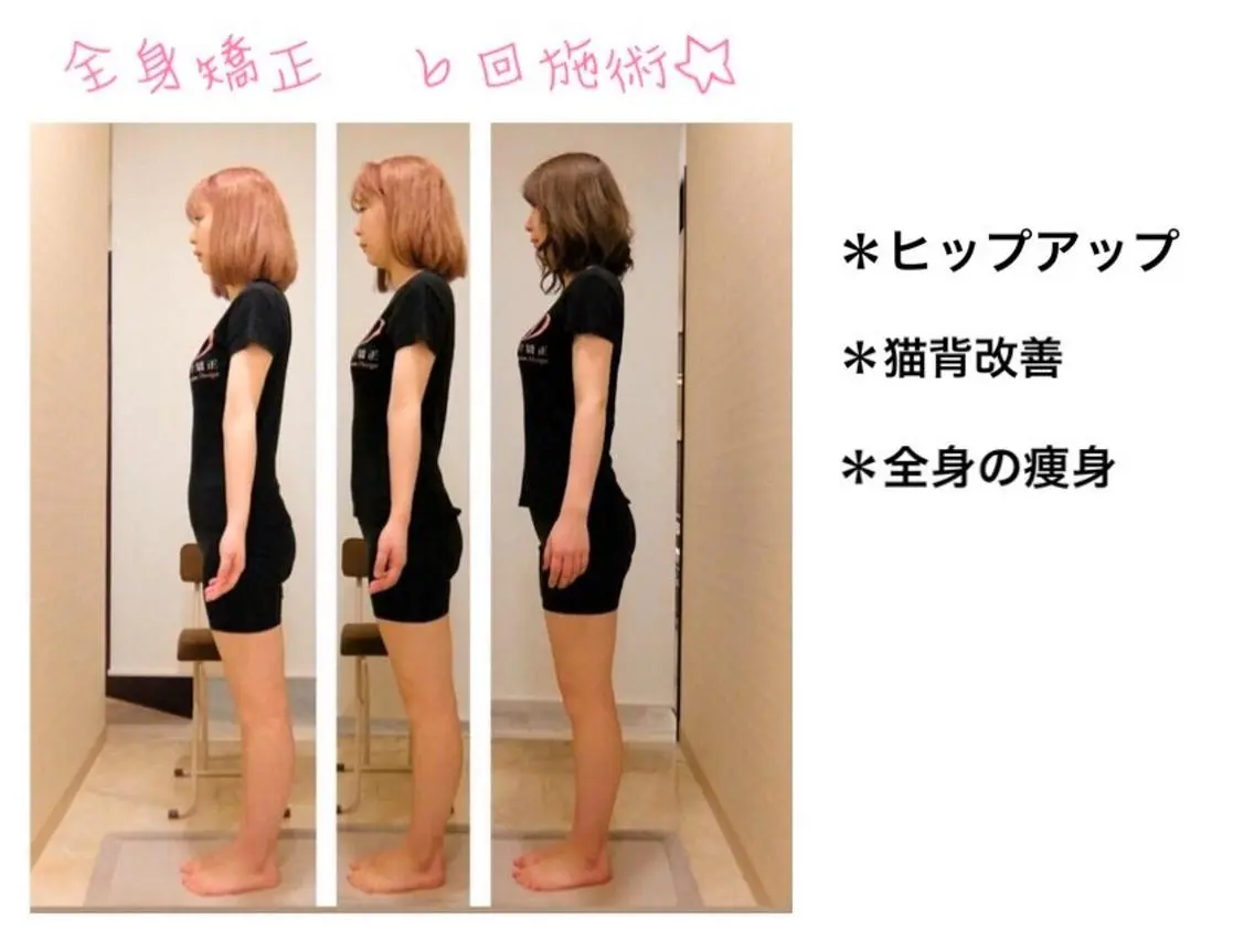 姿勢・骨盤/小顔矯正 痩身ダイエット 横田のエステ・リラクイメージ