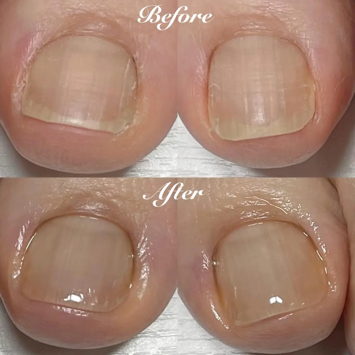 ネイル フットネイル .Nails Mio 赤羽西ネイルサロンのネイルデザイン