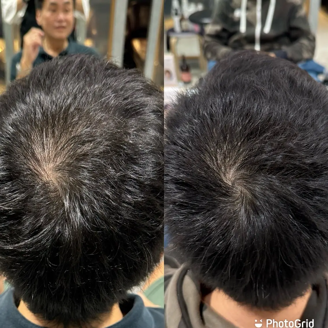 メンズカット➕アズフレイヤ製　純度100%エクソソームで育毛の写真