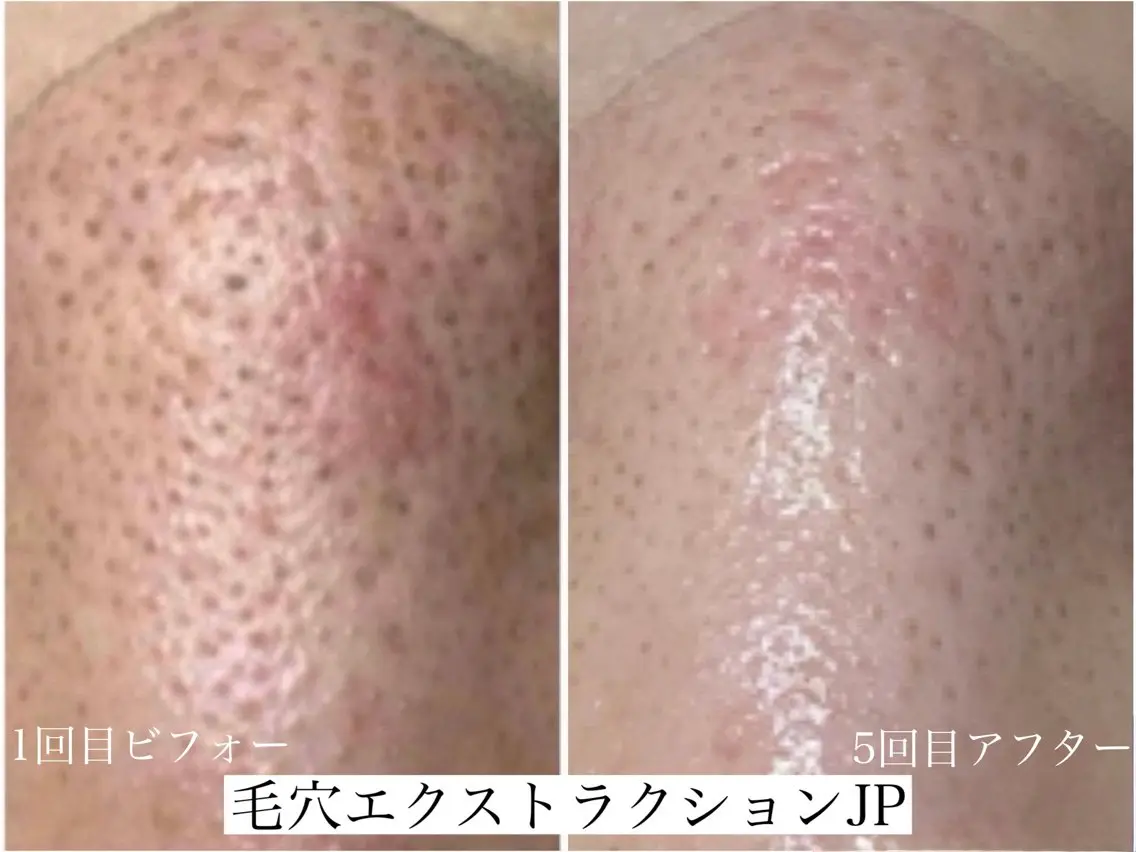 エステ 佐々木 風奈のエステ・リラクイメージ