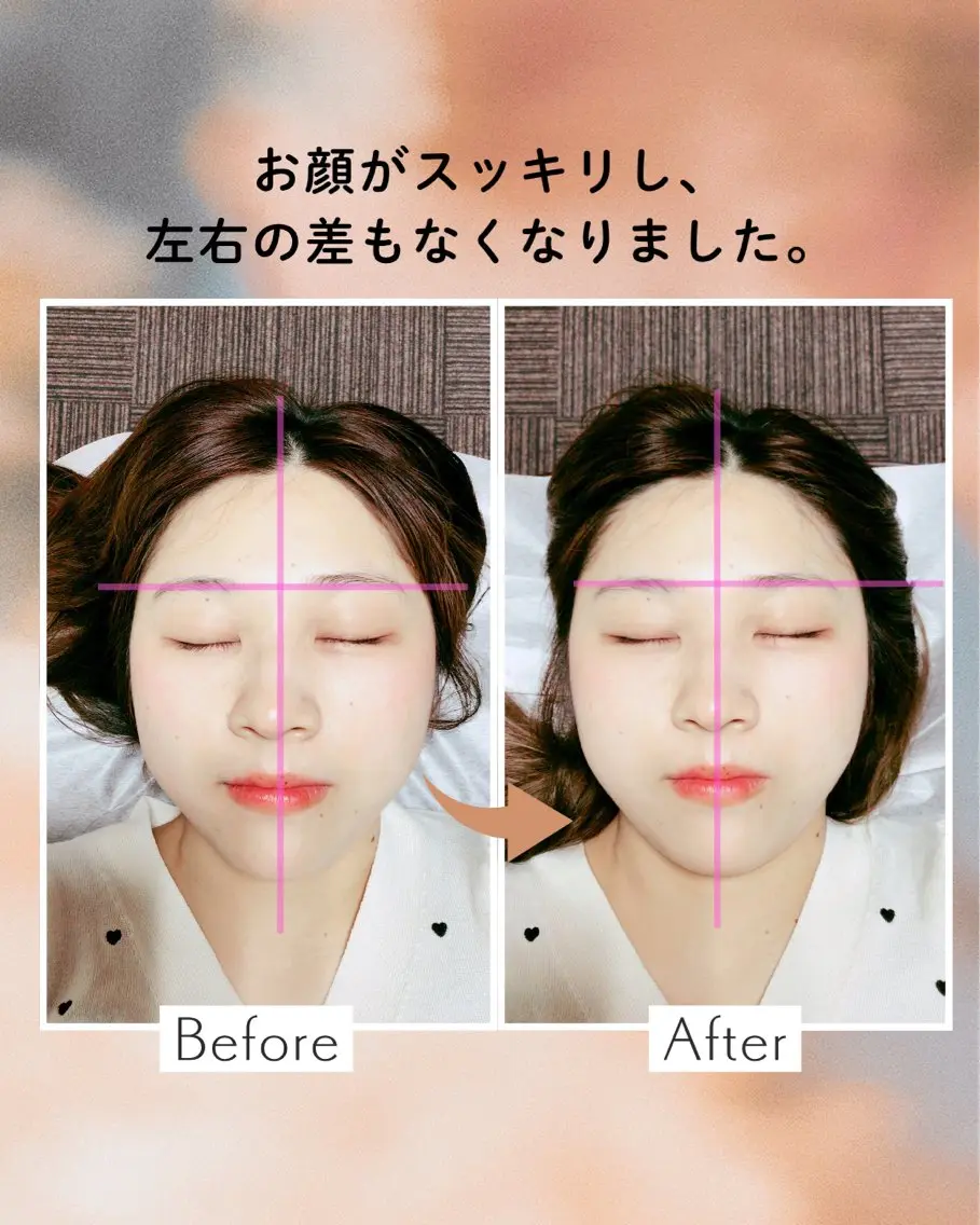 山﨑 竜二のエステ・リラクイメージ
