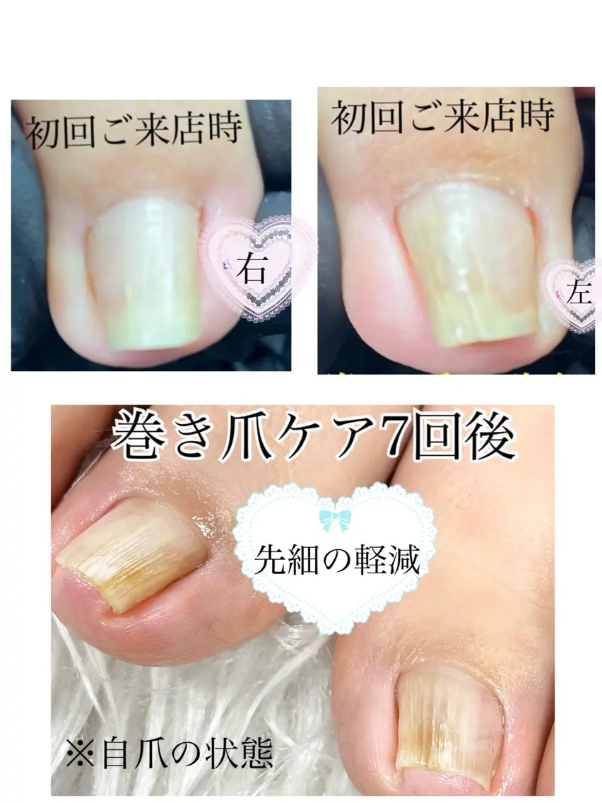 ネイル フットネイル 東京あきる野市ネイル ✿ ｙｕiのネイルデザイン